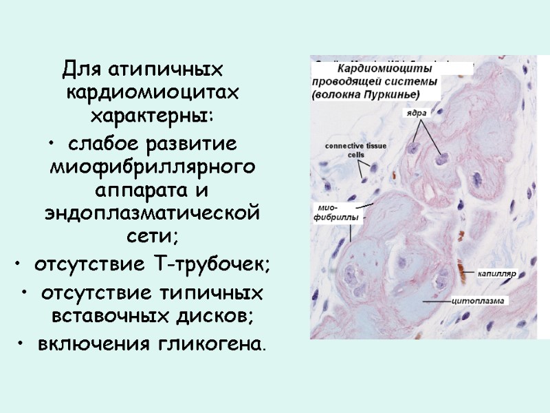 Для атипичных кардиомиоцитах характерны:  слабое развитие миофибриллярного аппарата и эндоплазматической сети; отсутствие Т-трубочек;